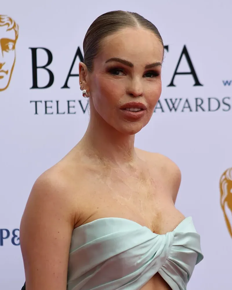 Katie Piper