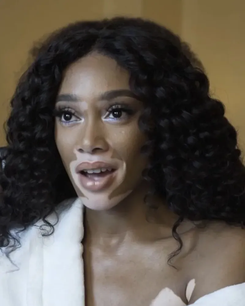 Winnie Harlow